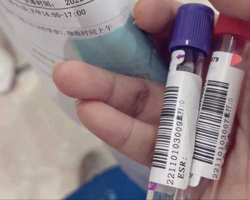 乌克兰正规代生地址,乌克兰助孕机构排名？单身女性去乌克兰做试管生双胞胎