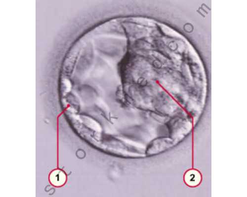 乌克兰借卵生子的费用成功率,做试管婴儿发现AMH值低应该怎么调理？_江西哪家