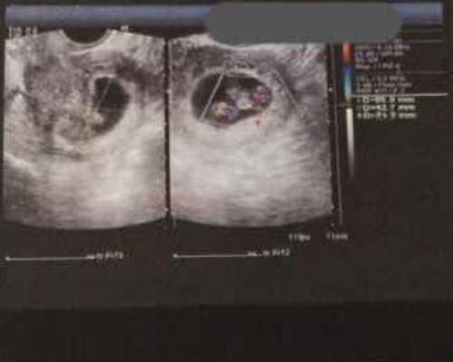 产妇产后必须做的保健检查