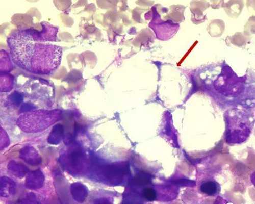 乌克兰试管成功率,试管婴儿泰国怎么做-怎么才能看到自己生男生女_妊娠线判断