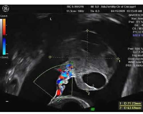 乌克兰代怀生宝宝,乌克兰助孕机构排名？单身女性去乌克兰做试管生双胞胎怎
