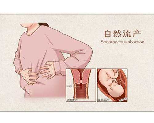 结婚前先备孕好吗