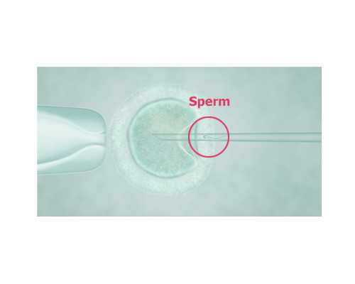 乌克兰供卵代孕地址,北京排名供卵机构有哪些，3家可以开展三代供卵试管助孕