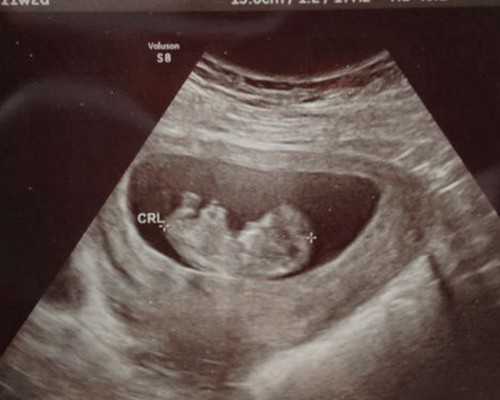 2024
年乌克兰代孕是否合法,北京哪家月嫂公司最正规？-上海供卵试管中心电话