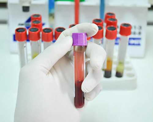 乌克兰代怀中介,泰国试管婴儿移植手术的条件是什么？_乌克兰医院驻中国-试管