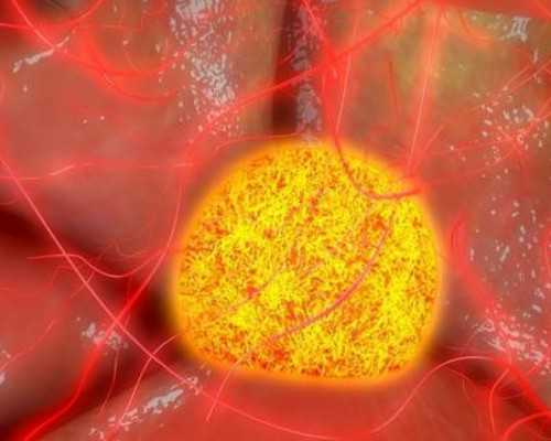 乌克兰代生小孩合法吗,乌克兰供卵多少钱，乌克兰供卵试管费用及其影响因素