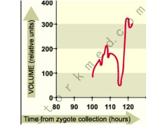 婴儿几个月把尿