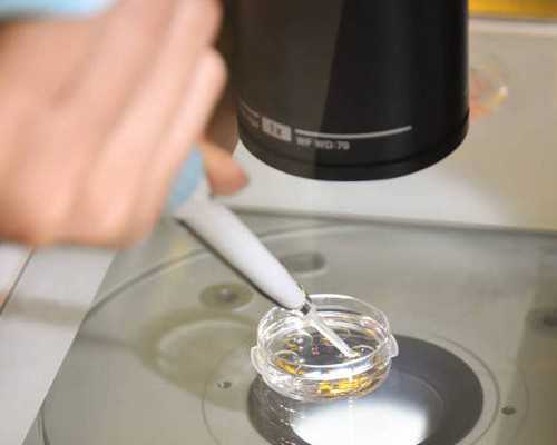 乌克兰高龄借卵价格,北京供卵中介博诺（枣庄供卵中介）_怀孕后不脱发了生男