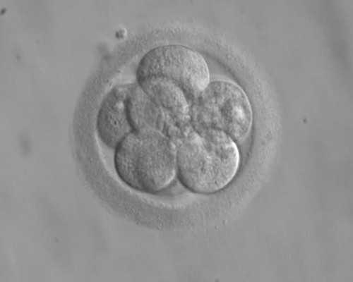 乌克兰供卵的医院,枣庄姐妹去做泰国试管婴儿助孕之前知道需要准备什么？-试