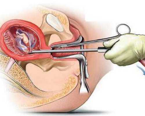 乌克兰辅助生殖,没有子宫怎么生自己的孩子!北京供供卵试管机构助您怀孕_啥
