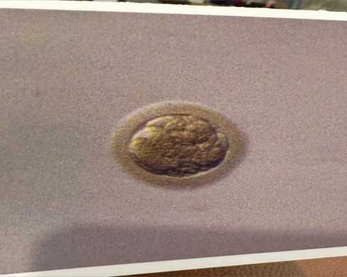 乌克兰有正规代孕公司,乌克兰供卵试管婴儿攻略,2024
乌克兰供卵试管中心