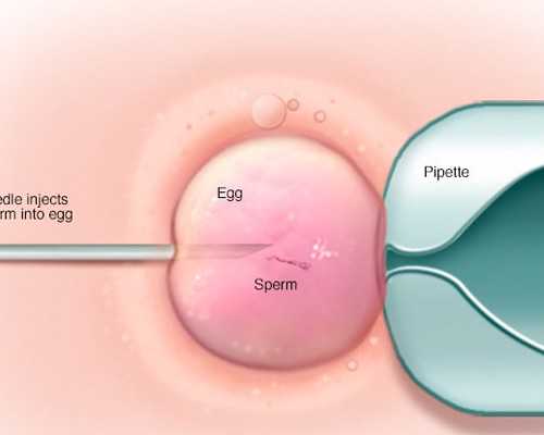 乌克兰有代生吗,乌克兰供卵试管技术好不好（乌克兰捐卵）
