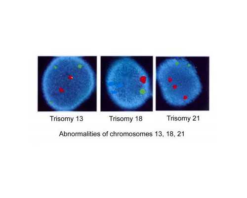 国内知名的乌克兰代孕,北京合法供卵试管中心（广东做三代试管婴儿医院最好