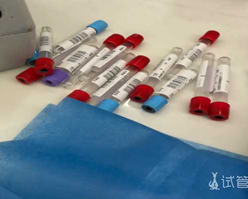 乌克兰试管代怀流程,乌克兰助孕试管婴儿移植后腹痛是什么原因_做试管用不用