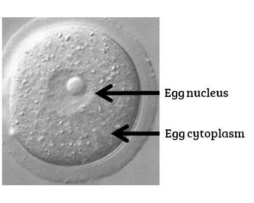 乌克兰同志代生费用,乌克兰做供卵试管多少钱，乌克兰供卵试管的优势、流程
