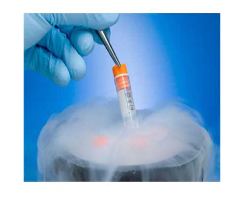 乌克兰代生得子,俄罗斯试管婴儿过程中怎样监测排卵？-中信湘雅医院和中南大