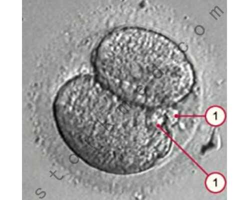 乌克兰供卵正规来源,乌克兰供卵试管婴儿攻略_乌克兰助孕供卵试管的选择