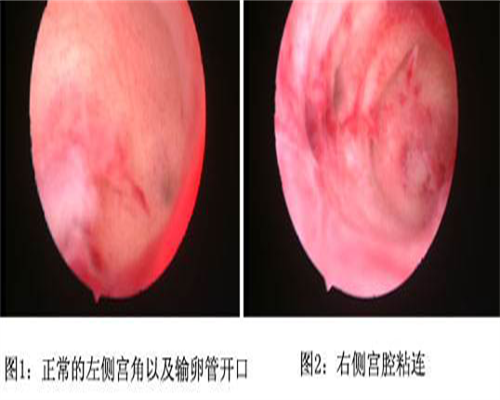 长沙附睾炎不育家庭的费用与成功率指引