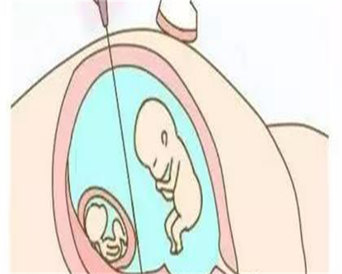 长沙45岁以上拉拉做试管婴儿，这些医学风险要知道